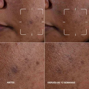2331 (2) Even Better Clinical Dark Spot Clearing Serum